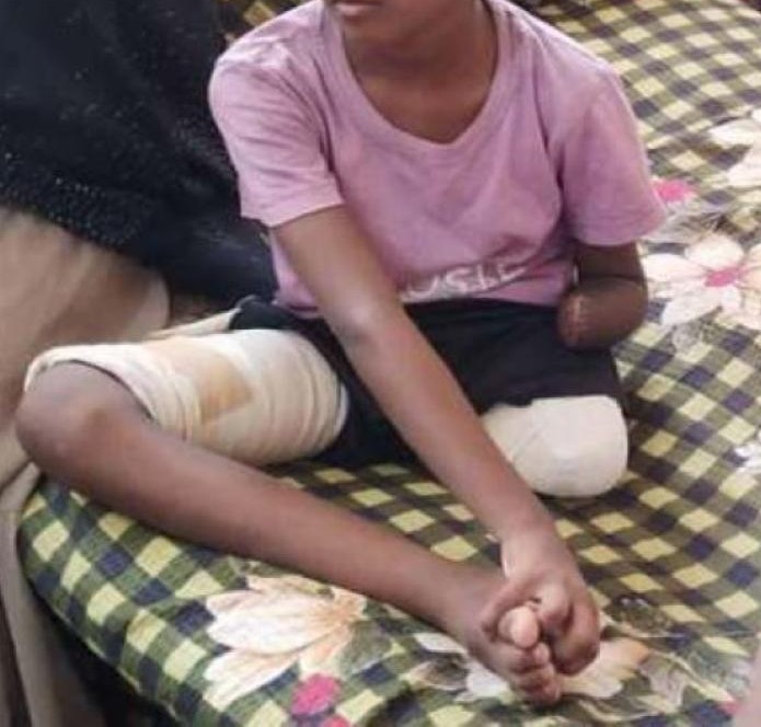 حرب السودان .. عندما تحولت أجساد المدنيين إلى ساحات معركة